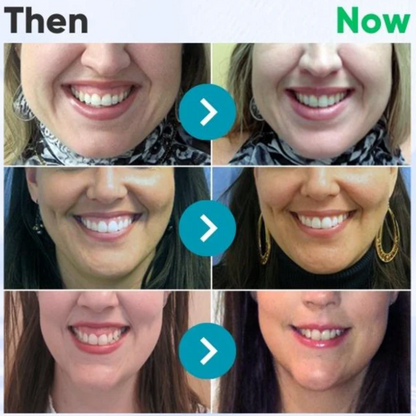 🐝platefule VioCore Tandpasta met bijengif voor tandheelkundige behandeling