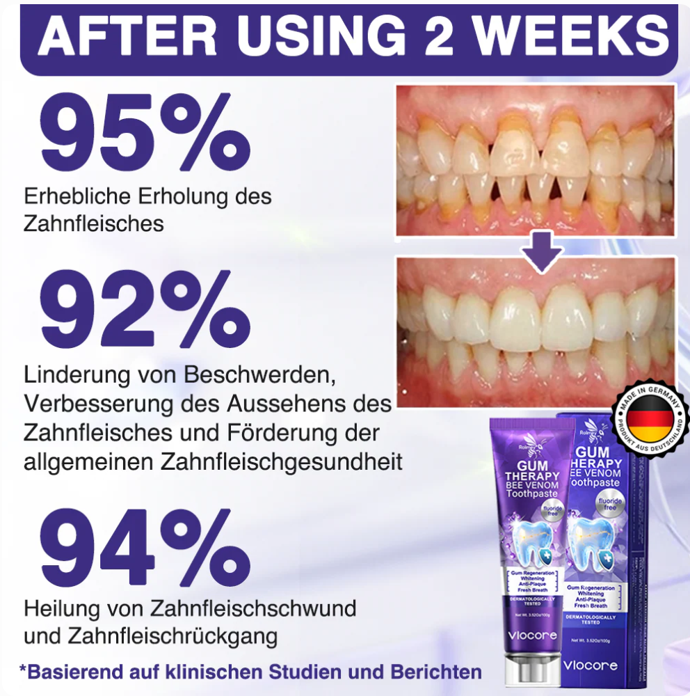 🐝platefule VioCore Tandpasta met bijengif voor tandheelkundige behandeling