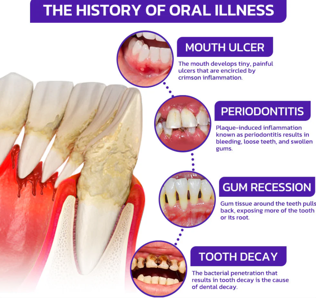 🐝platefule VioCore Tandpasta met bijengif voor tandheelkundige behandeling