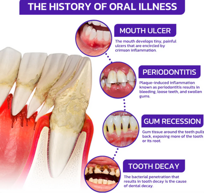 🐝platefule VioCore Tandpasta met bijengif voor tandheelkundige behandeling